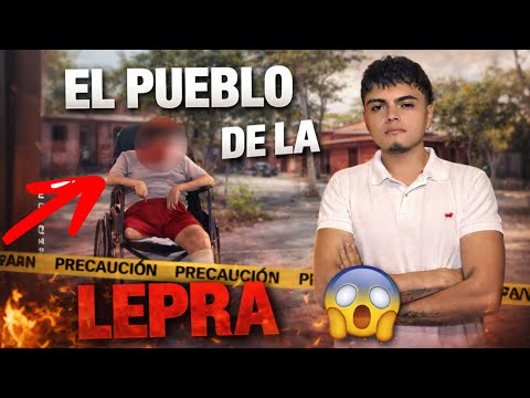CONOCI el pueblo de la LEPRA - Agua de Dios - LEPROSARIO
