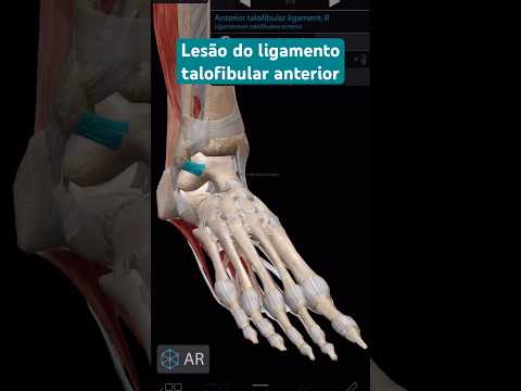 Lesão do ligamento talofibular anterior #fisioterapia #exercícios #cinesioterapia