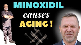 Minoxidil for Hair Loss | Side Effects