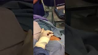 Miniatura del video