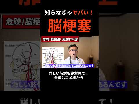 脳卒中の5つの主な症状とその対処法