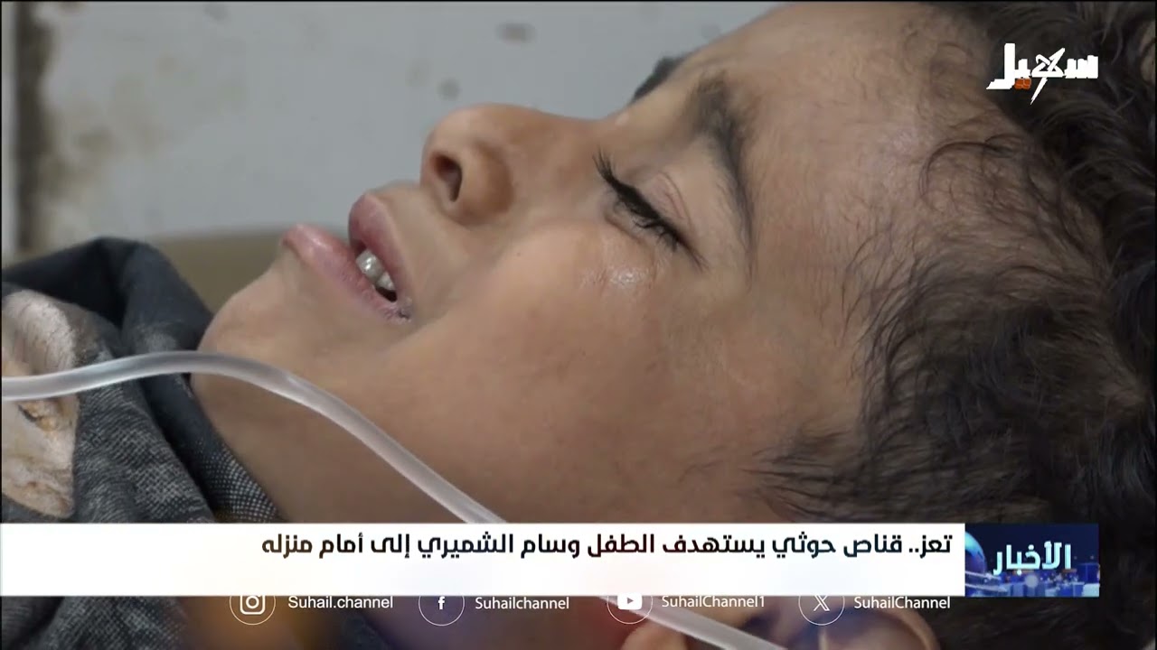 قناص #حوثي يستهدف الطفل وسام الشميري من أمام منزله