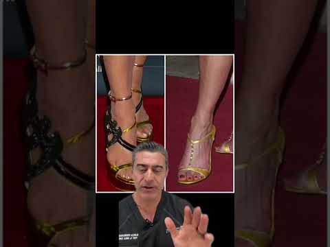 Celebrities with foot condition Ep. #14 -  Paula Abdul
