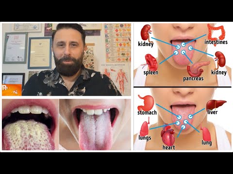 KUJDES! Ngjyra dhe forma e GJUHËS paralajmërojnë sëmundje të fshehta