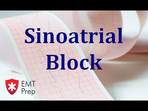 Sinoatrial Block ECG - EMTprep.com