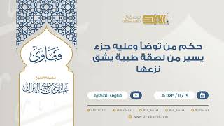 حكم من توضأ وعليه جزء يسير من لصقة طبية يشق نزعها - للشيخ عبدالرحمن البراك(9332) image