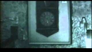 Silent Hill 4 - Alexander the Burn Victim