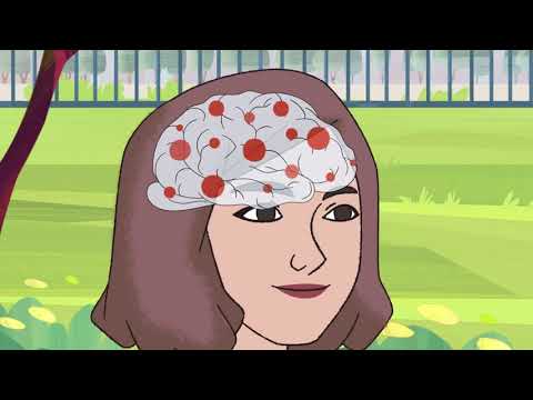 Shkaktarët e epilepsive