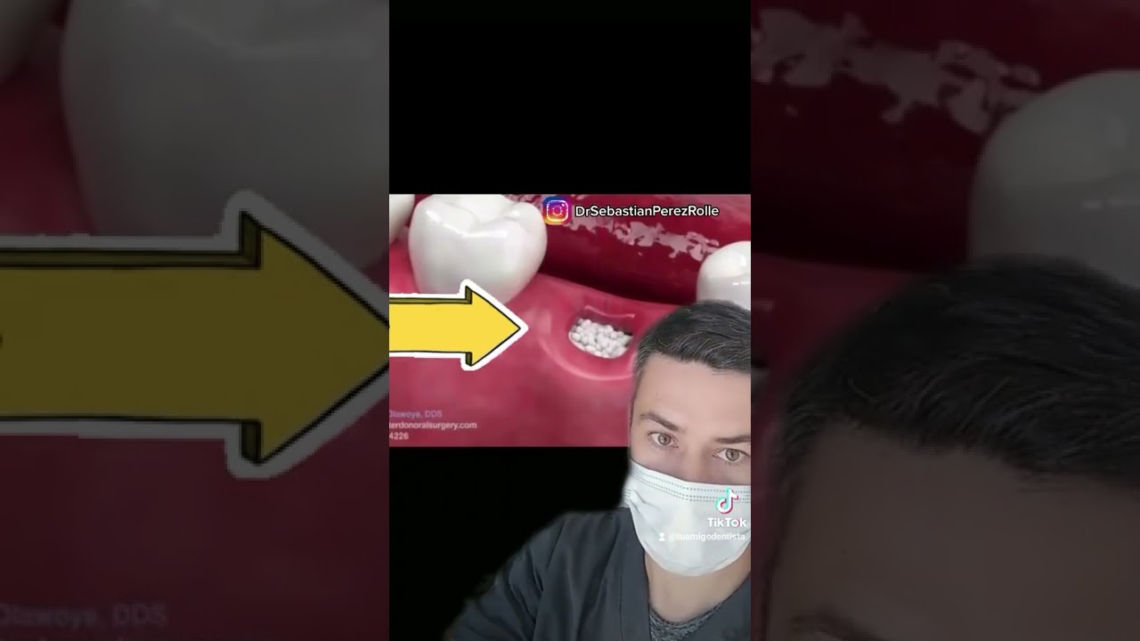 Sebastián Pérez Rolle-14