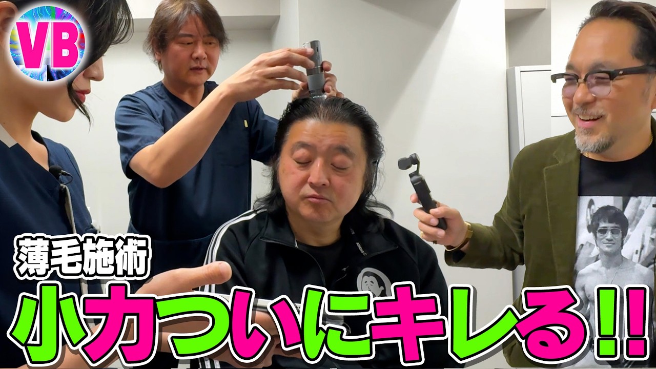 長州小力５４歳の増毛施術に完全密着‼️変わっていいかも✨