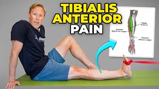 Tibialis Anterior Tendonitis Exercises