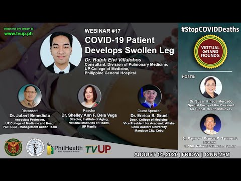 Webinar #17 | COVID-19 Patient Develops Swollen Leg