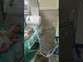 Ventilator In Nicu वेंटीलेटर Youtubeshorts Shorts Nicubaby Medical Hospital Pediat