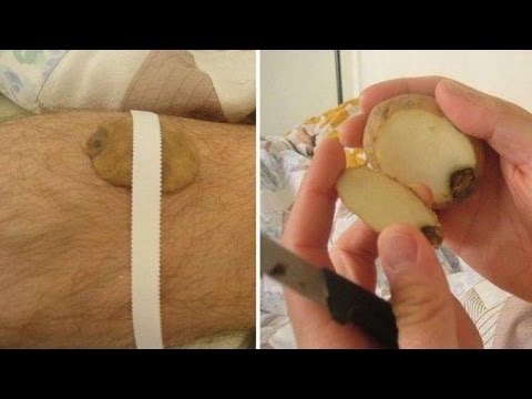 Slimming gatas tistle buto Mawalan ng Timbang sa Dr. Slim