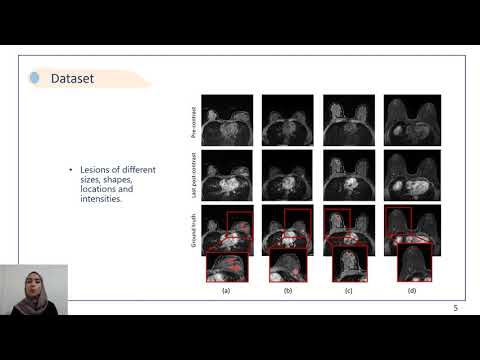 Deep Learning Based Segmentation of Breast Lesions in DCE-MRI