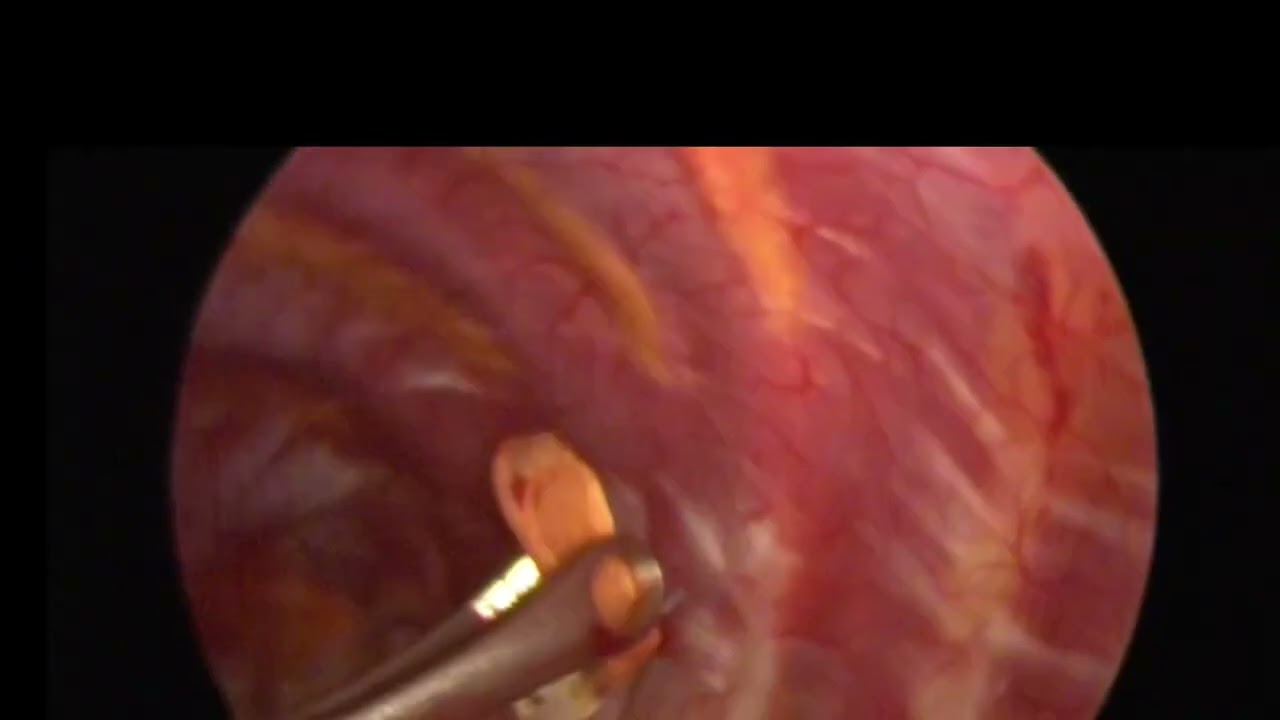 Fernando Espinoza Mercado-28