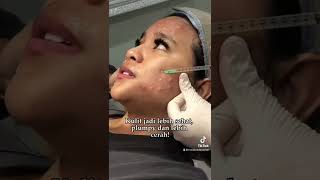 Download lagu Nutrisi kulit dengan skin booster!✨#skinbooster #TangkapMini #instabeautycenter #buy1get1 #glowing mp3