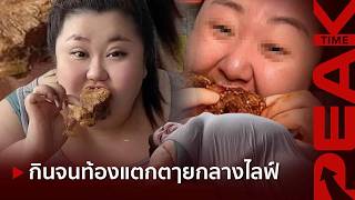 สลดคาไลฟ์ อินฟลูสาวกินจุจนท้องแตกตๅย หมอตะลึงเจออาหารสด ๆ ที่ยังไม่ย่อยดิ้นเต็มท้อง | PEAK TIME