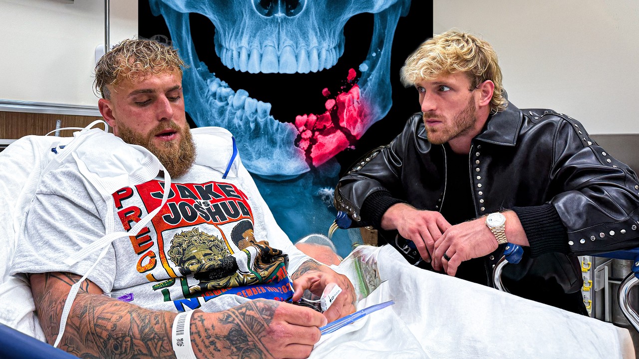 Anthony Joshua Broke My Brother’s Jaw