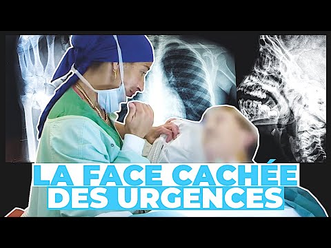 La face cachée des urgences : sommes-nous vraiment bien soignés ?