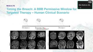 Invited Research Meeting - Illuminating the brain: cutting-edge imaging solutions for neuroscience