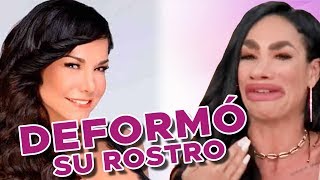 LIS VEGA DESTROZA su cara con Botox y Relleno