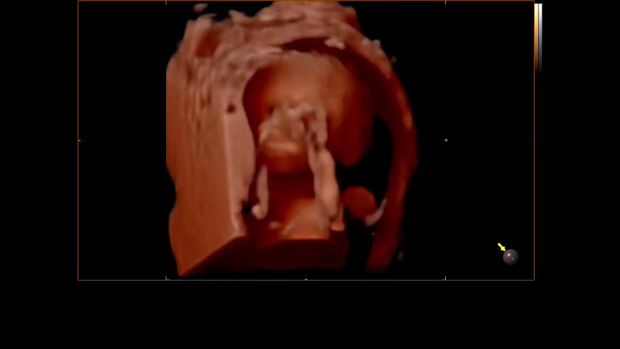 Şahver Melek Avcı Orhun-13