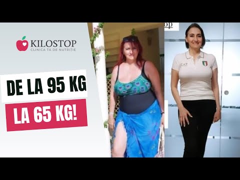 Schimbare Radicală: Povestea Mea de Slăbire cu Kilostop