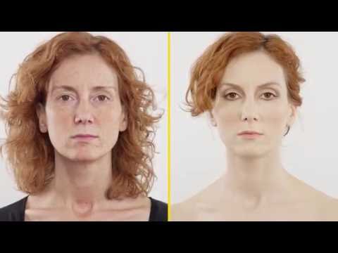 How to cover freckles with RiparCover Camouflage