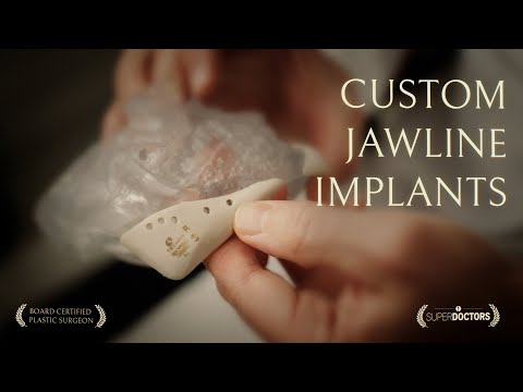 Custom Jaw Implants After Bimax Surgery — Dr. Jonathan Zelken