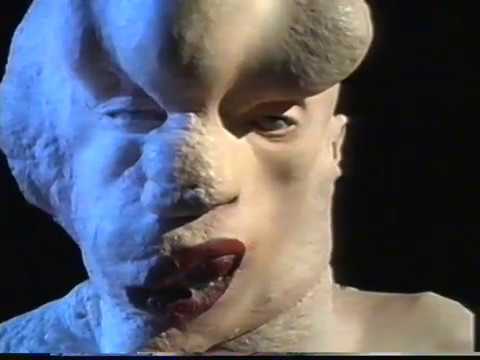 The Riddle of the Elephant Man - Joseph Merrick