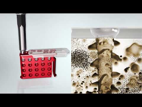 SonicWeld Rx® for midface trauma