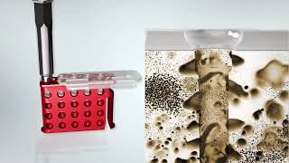 SonicWeld Rx® for midface trauma