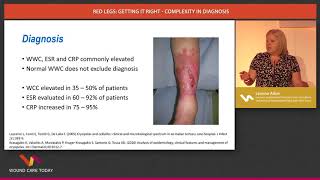Red legs: getting it right - complexity in diagnosis