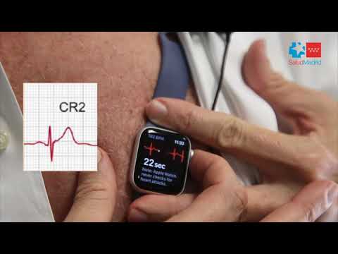 Cómo hacer un ECG con tu Apple Watch paso a paso