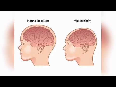 POINT MUTATION BY PHANINDRA GUPTHA
