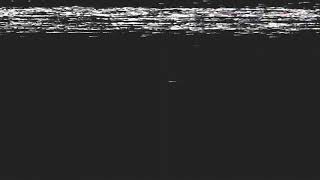 Download lagu RIVALITAS BONEK MANIA TERCIDUK DI STADION KANJURUHAN SAAT LAGA AREMA PERSEBAYA 6-10-2018 mp3 Download lagu RIVALITAS BONEK MANIA TERCIDUK DI STADION KANJURUHAN SAAT LAGA AREMA PERSEBAYA 6-10-2018 mp3