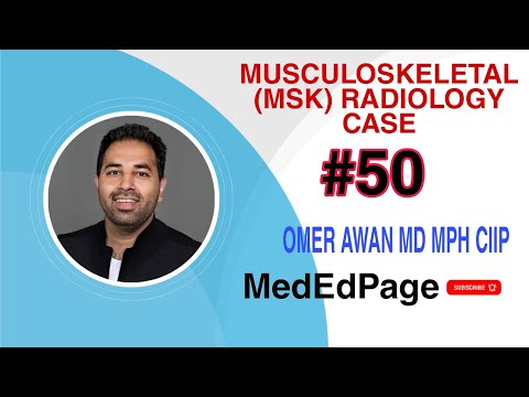 Musculoskeletal (MSK) Radiology CASE #50