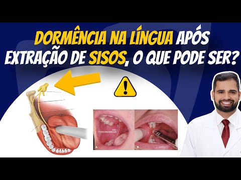 Francisco De Assis Almeida Lima Júnior-101