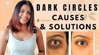 HOW TO REMOVE DARK CIRCLES UNDER EYES | HOW TO GET RID OF DARK CIRCLES | SOLUTION FOR DARK CIRCLES