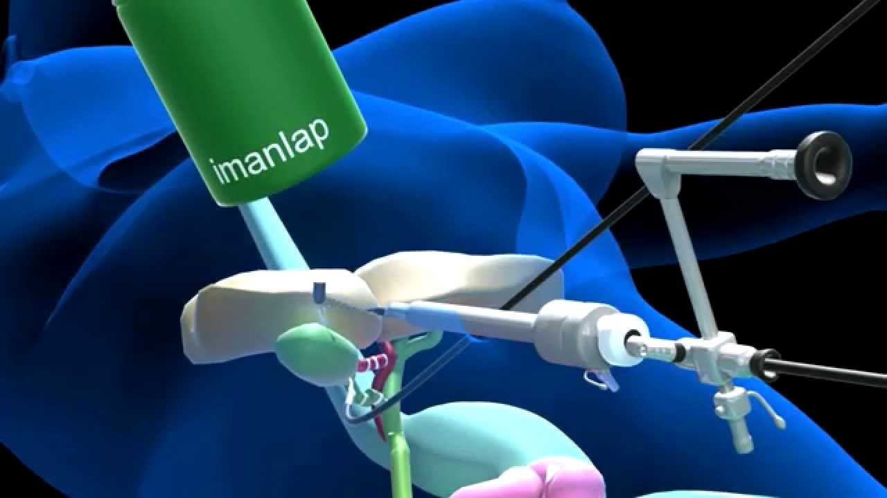 Javier Ricardo Villalva Méndez-17