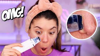 PROVO LA SPATOLA PER RIMUOVERE I PUNTI NERI 😱 FUNZIONA DAVVERO!