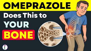 Omeprazole Side Effects: What Your Doctor Didn't Tell You