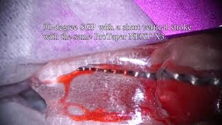 New Ai motor head with T mode