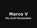 Marco V - My Acid Pacemaker Original