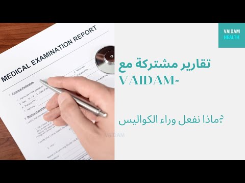 تقارير مشتركة مع Vaidam - ماذا نفعل وراء الكواليس؟