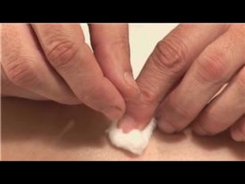 Acupuncture & Health : Acupuncture Help for Weight Loss