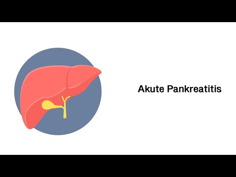 Akute Bauchspeicheldrüsenentzündung (Akute Pankreatitis)