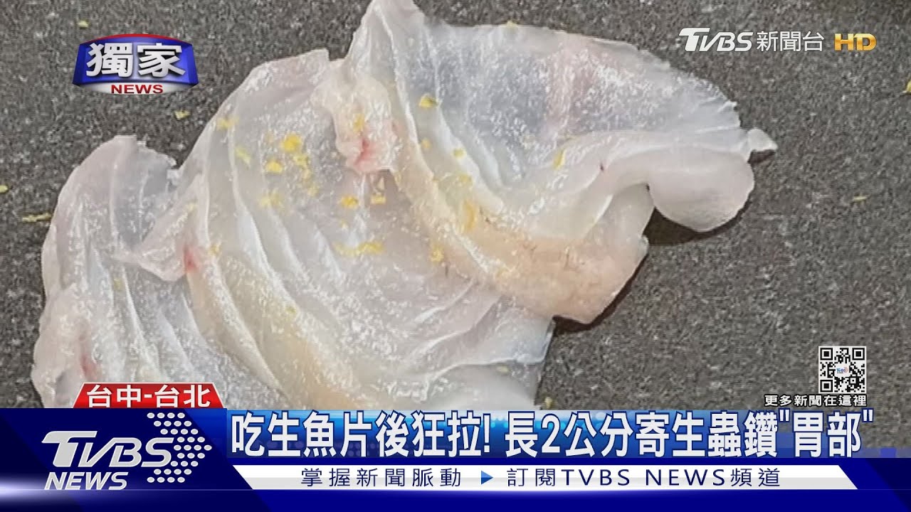 到高級日料店吃生魚片後狂拉！　胃裡抓出2公分「海獸胃線蟲」