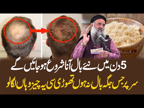 Hair Treatment At Home | Hair Fall Treatment | Hair Growth Oil | Balon Ka Ilaj By Dr Sharafat Ali